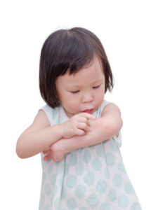 虫刺されの腕をさわる女児
